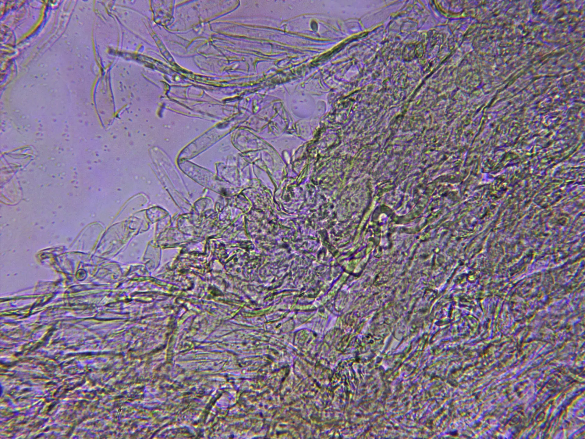 Microscopía de Leucoagaricus barssii - 10 - Pileipellis x400